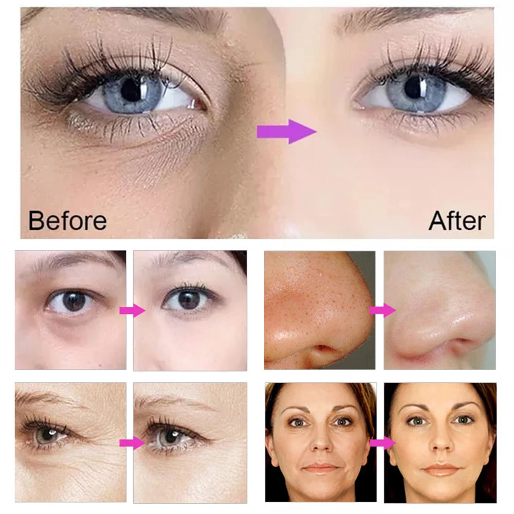 2024 NEW Dcool Portable Cool + Hot + EMS Facial Electroporation Machine – Skin Tightening, Anti-Puffiness Beauty Device