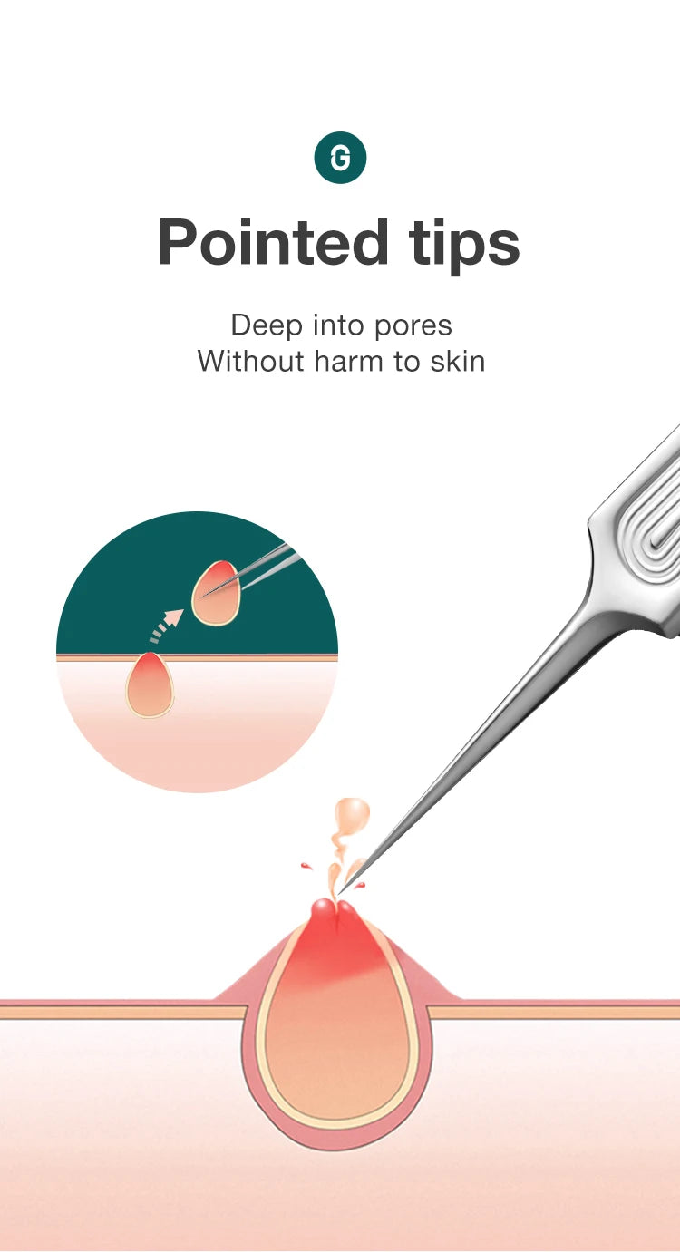 MR.GREEN Ingrown Hair Tweezers – Pointed Nose Tweezers for Eyebrows, Splinters, Blackhead & Acne Removal