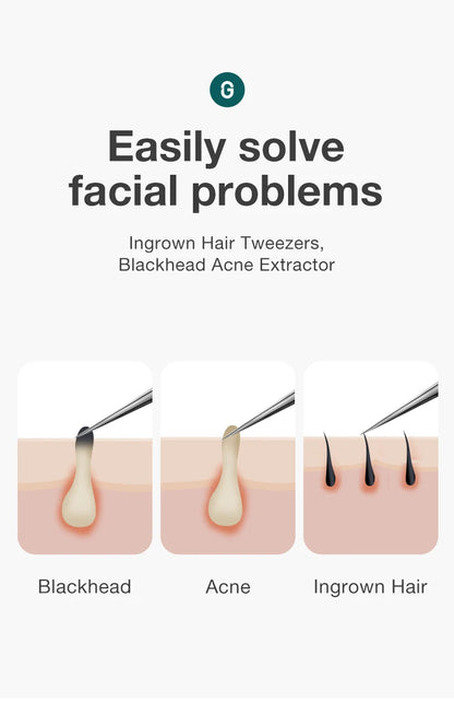 MR.GREEN Ingrown Hair Tweezers – Pointed Nose Tweezers for Eyebrows, Splinters, Blackhead & Acne Removal