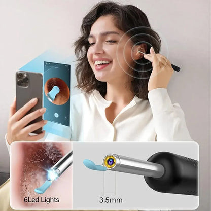 Wireless WiFi Ear Pick Otoscope Camera – Luminous Ear Wax Cleaner & Oral Inspection Health Care Kit