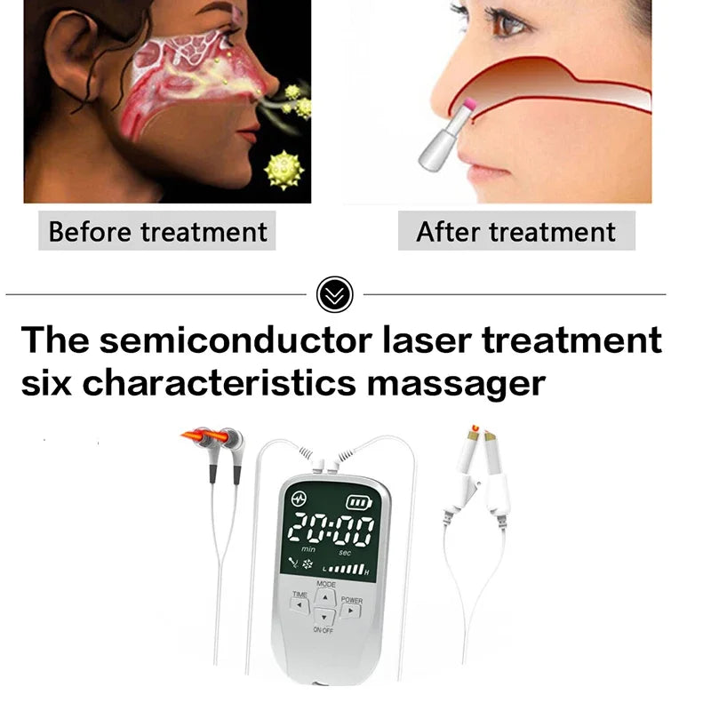 Portable Tinnitus Ear Laser Therapy – 650nm LLLT Irradiation Earplugs ...