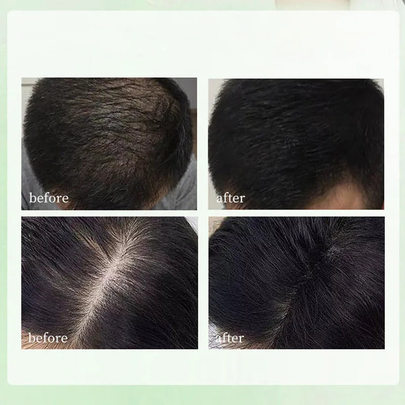 Natural Herbal Usman Grass Shampoo Soap – Handmade Hair Care for Nourishing, Oil Control & Refreshing Soft Hair