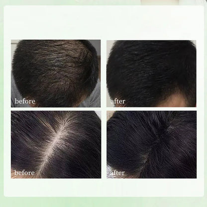 Natural Herbal Usman Grass Shampoo Soap – Handmade Hair Care for Nourishing, Oil Control & Refreshing Soft Hair