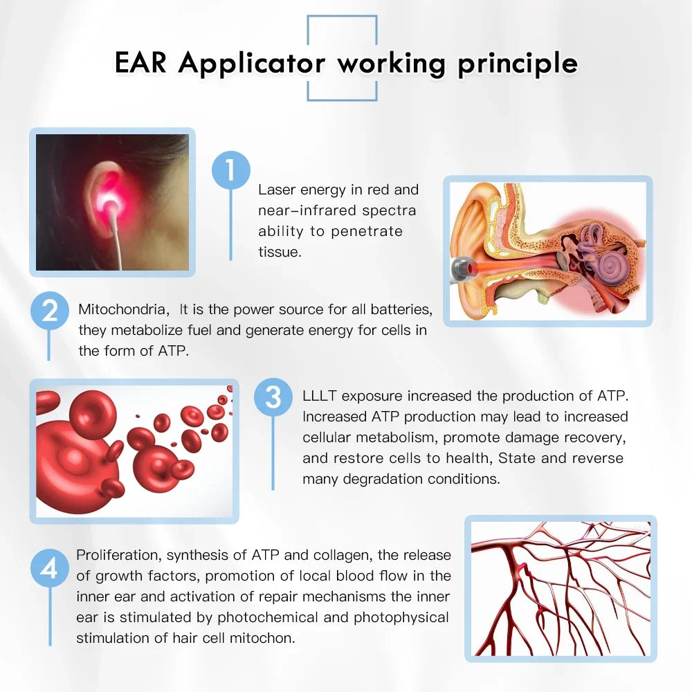 Portable Tinnitus Ear Laser Therapy – 650nm LLLT Irradiation Earplugs ...