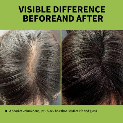 Rosemary Black Hair Dye Shampoo 500ml – DIY Herbal Gray-to-Black Coloring for Women & Men