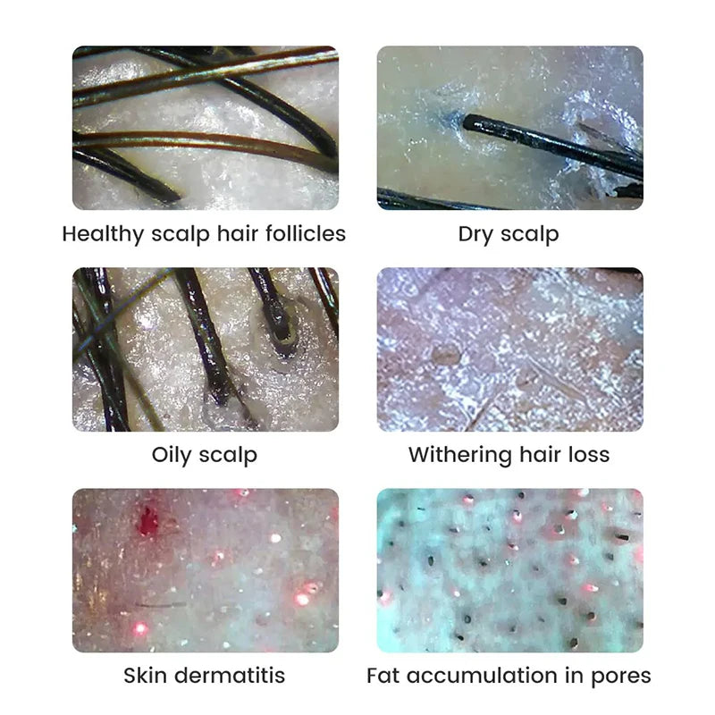 WiFi Digital Microscope - Wireless Electron Dermatoscope for Scalp Detection, Pores Magnifier & Skin Analyzer