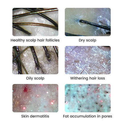 WiFi Digital Microscope - Wireless Electron Dermatoscope for Scalp Detection, Pores Magnifier & Skin Analyzer