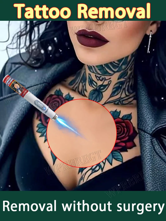 Blue Light Tattoo Removal Pen – Unisex, Suitable for All Ages, Free Shipping