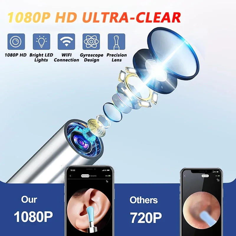 Visual Ear Wax Cleaner with Camera – Safe Luminous Otoscope Endoscope for Ear Cleaning & Ear Care