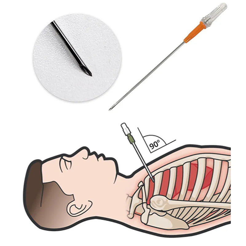 Chest Compression Needle Emergency First Aid Kit - Tension Pneumothorax Thoracic Needle, Medica ...