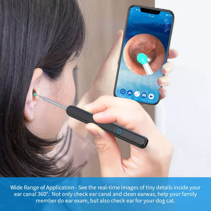 NATFIRE NE3 Ear Cleaner - High Precision Wireless Otoscope with Camera and LED Light - Smart Ear Wax Removal Tool Kit