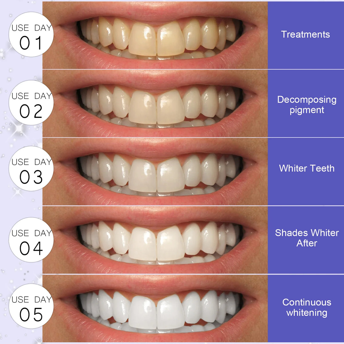 5D Whitening Teeth Stickers – 7/14 Pairs Gel Strips for Stain Removal ...
