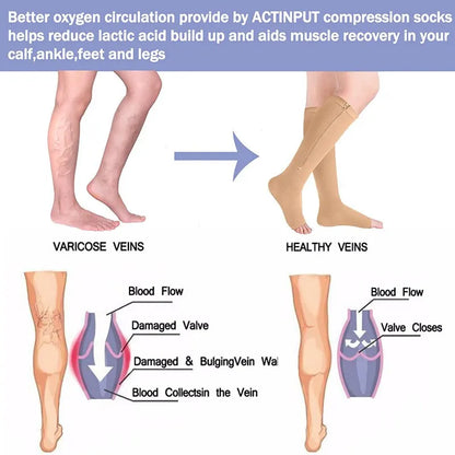 1 Pair Zipper Compression Socks: Pain Relief Stretchy Stockings for Women Men, Open Toe Compression Sports Socks Support