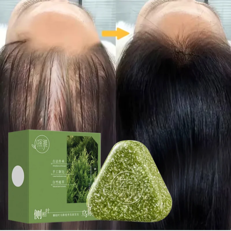 Natural Herbal Usman Grass Shampoo Soap – Handmade Hair Care for Nourishing, Oil Control & Refreshing Soft Hair