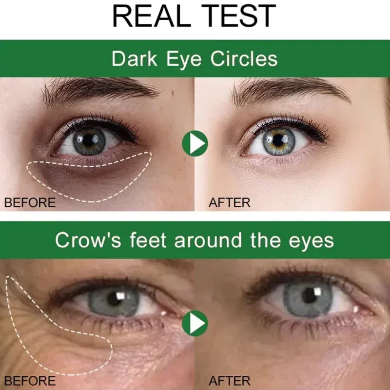 7-Day Tighten Wrinkles Eye Cream: Anti Dark Circles, Bags, Puffiness - Fades Fine Lines, Whitens Under Eye Skin - Korean Care Innovation
