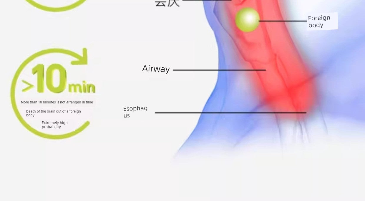 Anti-Choke First Aid Heimlich Device – Portable Anti-Suffocation Tool for Babies, Children & Elderly – Official Authentic Product