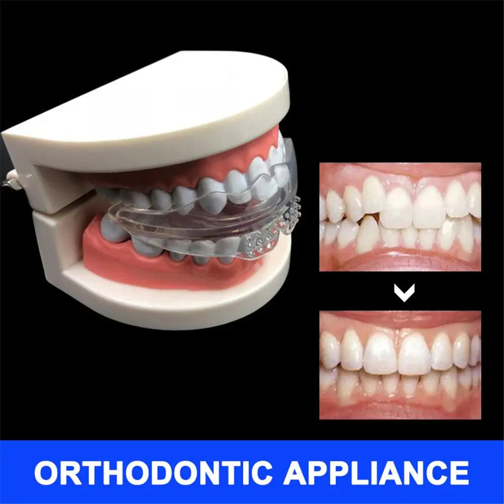 Orthodontic Braces Appliance – Silicone Teeth Alignment Trainer, Retai ...