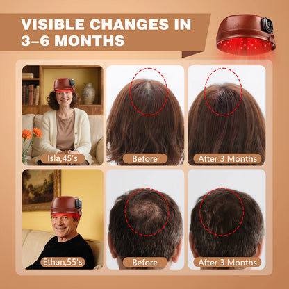 Laser Hair Growth Cap – 660nm & 850nm Red Light Therapy with 3000mAh Battery for Hair Regrowth, Anti-Hair Loss & Scalp Care