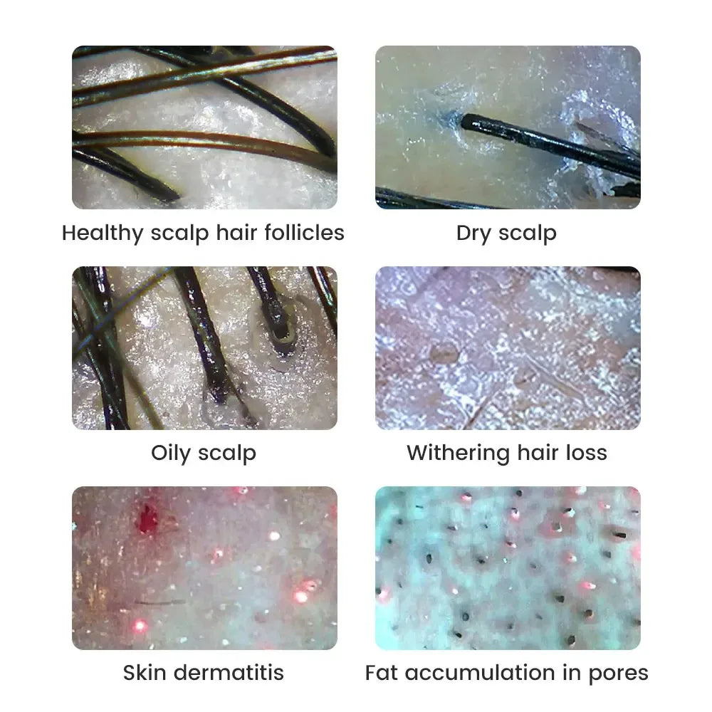 WiFi Digital Microscope - Wireless Electron Dermatoscope for Scalp Detection, Pores Magnifier & Skin Analyzer