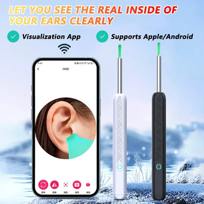 Visual Ear Wax Cleaner with Camera – Safe Luminous Otoscope Endoscope for Ear Cleaning & Ear Care