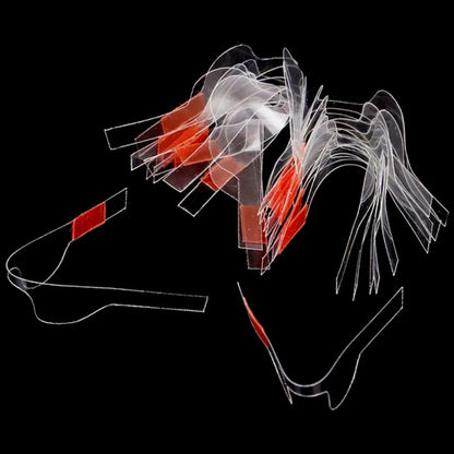 Dental Twin Anterior Matrix Orthodontic Contoured Metal Matrices – Polyester Dentist Matrix Materials