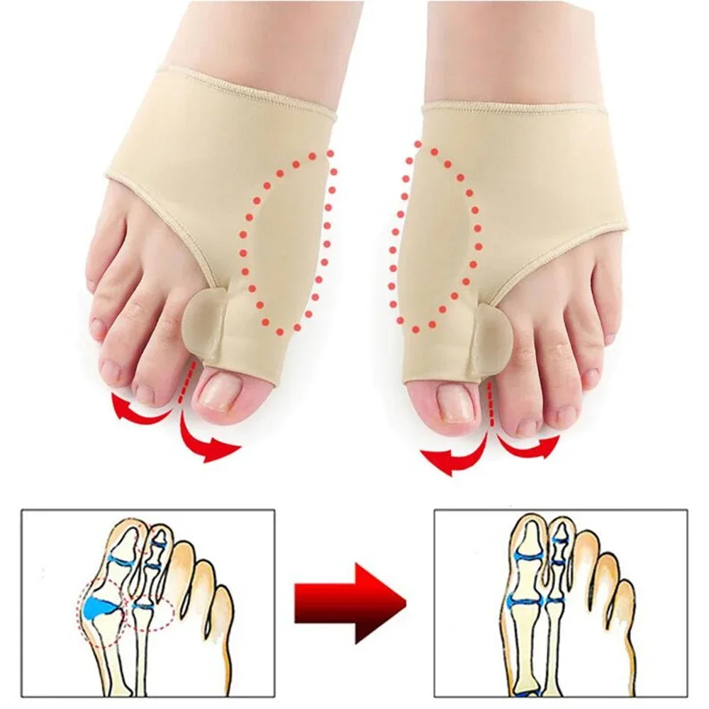 Toe Separator Bunion Corrector – Hallux Valgus Toe Pain Relief Foot Care Tool