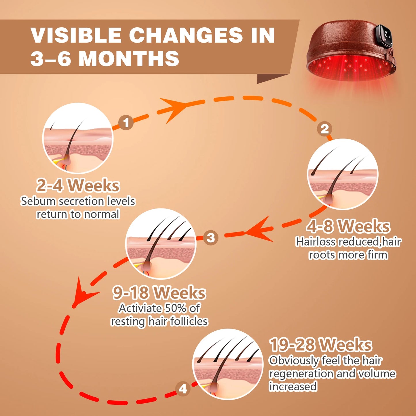 Laser Hair Growth Cap – 660nm & 850nm Red Light Therapy with 3000mAh Battery for Hair Regrowth, Anti-Hair Loss & Scalp Care