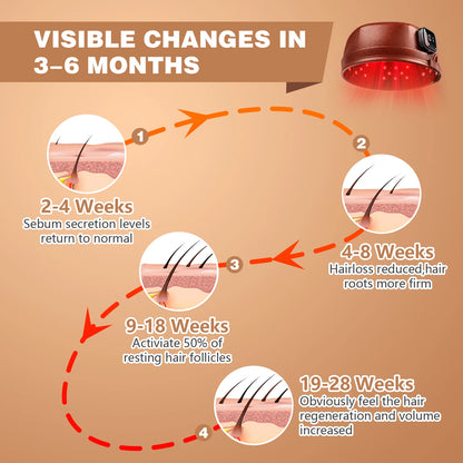 Laser Hair Growth Cap – 660nm & 850nm Red Light Therapy with 3000mAh Battery for Hair Regrowth, Anti-Hair Loss & Scalp Care