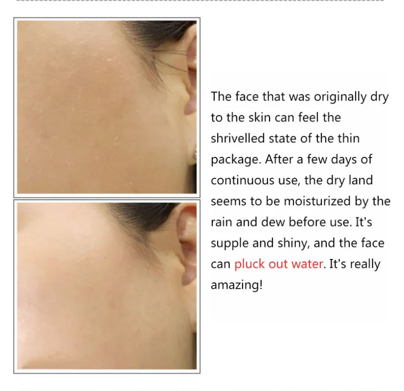 2% Hyaluronic Acid + B5 Serum – Hydrating & Nourishing Facial Essence for Smooth, Firm Skin