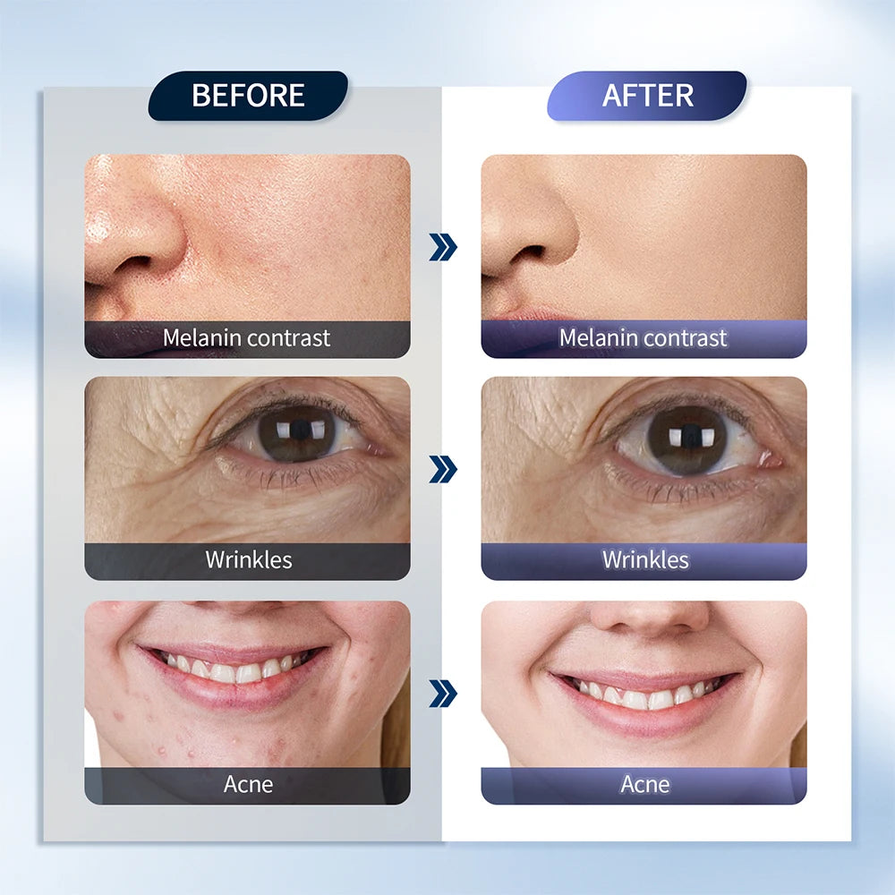 Foreverlily LED Face Mask PDT Machine – 7 Colors Light Photon Skin Rejuvenation, Facial & Body Beauty Spa with Nano Spray Mist