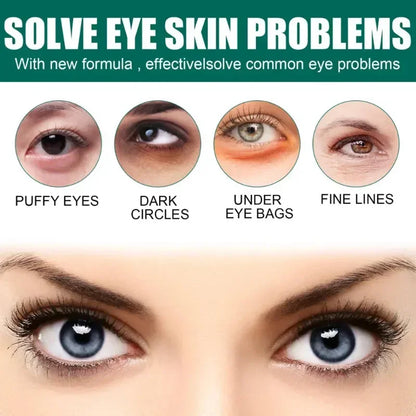 7-Day Tighten Wrinkles Eye Cream: Anti Dark Circles, Bags, Puffiness - Fades Fine Lines, Whitens Under Eye Skin - Korean Care Innovation