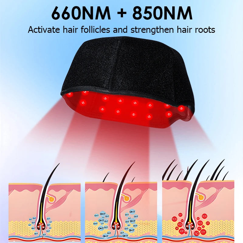 Red Light Therapy Hair Growth Cap – 660nm & 850nm Infrared Device for Hair Loss Treatment with USB Charging
